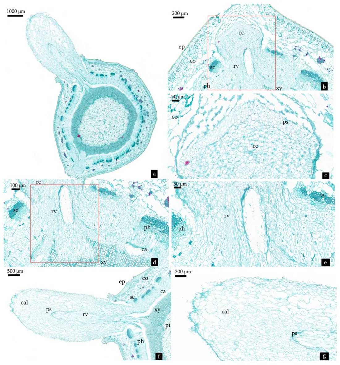 Microscope sections of a Magnolia cutting showing differentiated adventitious root primordia, root cap, root vascular tissue, and a new root emerging through the stem surface